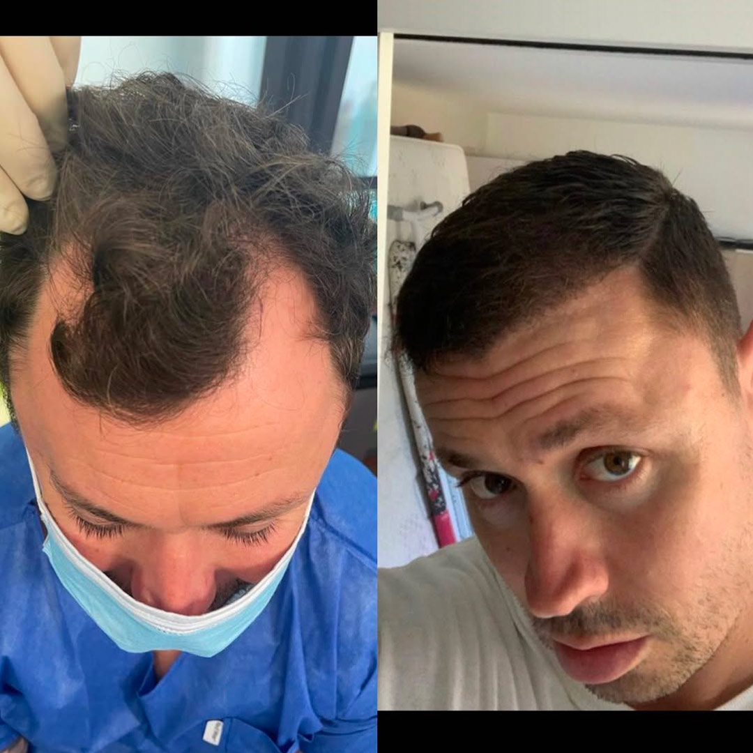 Dr Philippe Letertre, chirurgien esthétique à Nice