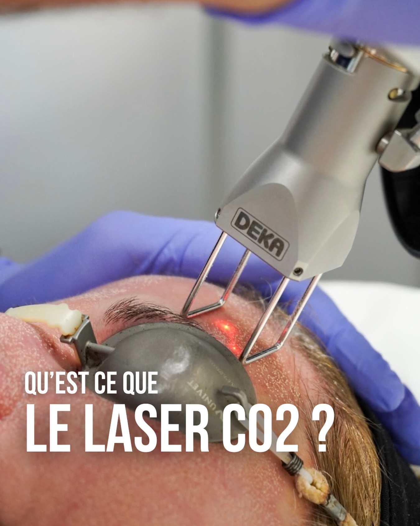 laser CO2